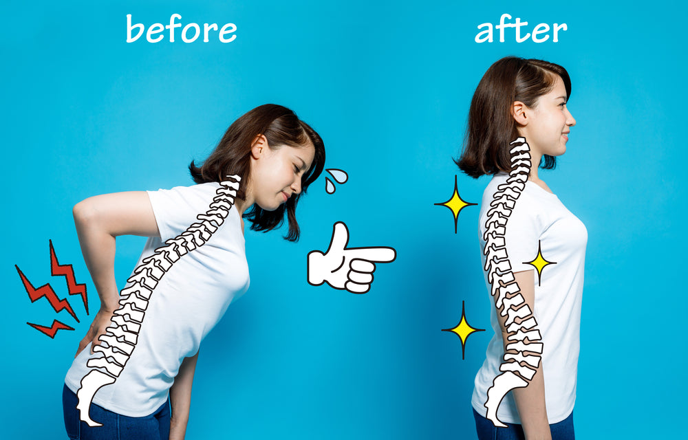 5 Simple Stretches to Help Improve Posture*